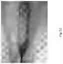 Fig. 52 - Medicament for Treating Peripheral Neuropathies