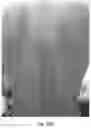 Fig. 57 - Medicament for Treating Peripheral Neuropathies