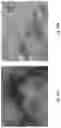 Fig. 59 - Medicament for Treating Peripheral Neuropathies