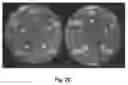 Fig. 05 - ENGINEERED BIOCOMPATIBLE ANTIBIOTIC PARTICLES AND THEIR USE AGAINST URINARY TRACT INFECTION
