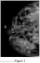 Fig. 02 - Methods of Reducing Mammographic Breast Density and/or Breast Cancer Risk