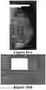 Fig. 15 - Methods of Reducing Mammographic Breast Density and/or Breast Cancer Risk