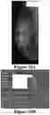 Fig. 19 - Methods of Reducing Mammographic Breast Density and/or Breast Cancer Risk