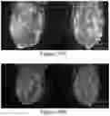Fig. 28 - Methods of Reducing Mammographic Breast Density and/or Breast Cancer Risk