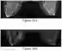Fig. 29 - Methods of Reducing Mammographic Breast Density and/or Breast Cancer Risk