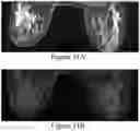 Fig. 30 - Methods of Reducing Mammographic Breast Density and/or Breast Cancer Risk