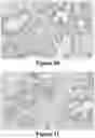 Fig. 43 - Methods of Reducing Mammographic Breast Density and/or Breast Cancer Risk