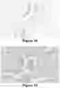 Fig. 45 - Methods of Reducing Mammographic Breast Density and/or Breast Cancer Risk