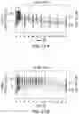 Fig. 32 - COMPOSITIONS OF OBETICHOLIC ACID AND METHODS OF USE
