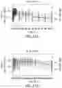 Fig. 33 - COMPOSITIONS OF OBETICHOLIC ACID AND METHODS OF USE
