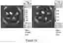 Fig. 24 - CFTR MRNA compositions and related methods and uses
