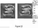 Fig. 25 - CFTR MRNA compositions and related methods and uses