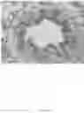 Fig. 46 - CFTR MRNA compositions and related methods and uses