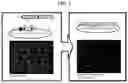 Fig. 02 - COMPOSITION FOR PREVENTING OR TREATING BONE DISEASES WHICH HAS EXCELLENT BONE REGENERATION EFFECT