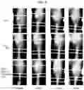 Fig. 10 - COMPOSITION FOR PREVENTING OR TREATING BONE DISEASES WHICH HAS EXCELLENT BONE REGENERATION EFFECT
