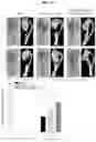 Fig. 11 - COMPOSITION FOR PREVENTING OR TREATING BONE DISEASES WHICH HAS EXCELLENT BONE REGENERATION EFFECT