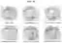 Fig. 20 - COMPOSITION FOR PREVENTING OR TREATING BONE DISEASES WHICH HAS EXCELLENT BONE REGENERATION EFFECT