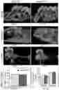 Fig. 03 - Compositions and methods for delivering lypophilic agents to dental pulp and for enhancing dentin production