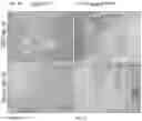 Fig. 07 - Compositions and methods for delivering lypophilic agents to dental pulp and for enhancing dentin production