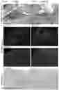 Fig. 13 - Compositions and methods for delivering lypophilic agents to dental pulp and for enhancing dentin production