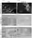 Fig. 15 - Compositions and methods for delivering lypophilic agents to dental pulp and for enhancing dentin production