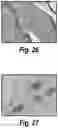 Fig. 27 - Methods and compositions for CNS delivery of iduronate-2-sulfatase