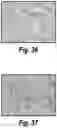 Fig. 32 - Methods and compositions for CNS delivery of iduronate-2-sulfatase