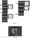 Fig. 13 - Novel Method of Treating Macular Degeneration Using Botulinum Toxin-Based Pharmaceuticals