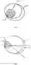 Fig. 02 - CONTRAST MIXTURE AND USE THEREOF