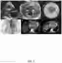 Fig. 04 - Systems and Methods for the Detection of Hydroxychloroquine-Mediated Cardiotoxicity
