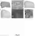 Fig. 05 - Systems and Methods for the Detection of Hydroxychloroquine-Mediated Cardiotoxicity