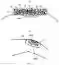 Fig. 03 - HYDROGEL SURGICAL DRESSING PRODUCT HAVING A MULTI-DIMENSIONAL FLEXIBLE HYDROPHILIC STRUCTURE-LINKAGE COMPOSITE