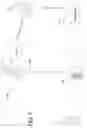 Fig. 06 - Optimizing peritoneal dialysis using a patient hand-held scanning device