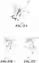 Fig. 29 - Safety-enhanced needle-free injector