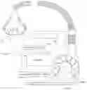 Fig. 01 - Mechanical ventilation in the presence of sleep disordered breathing