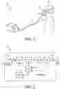 Fig. 02 - Systems and methods for concurrent airway stabilization and pulmonary stretch receptor activation