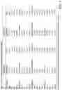 Fig. 07 - Device and method for controlling respiration during sleep