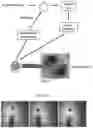 Fig. 35 - Method and apparatus for computer-vision guided targeted delivery of small liquid volumes into selected lung regions