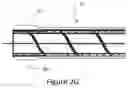 Fig. 06 - Vascular re-entry catheter