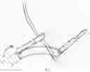 Fig. 03 - Locking line tag