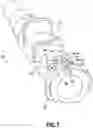 Fig. 07 - Catheter assembly
