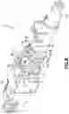 Fig. 08 - Catheter assembly