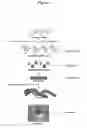 Fig. 06 - Cerebrospinal fluid purification system