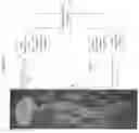 Fig. 07 - Cerebrospinal fluid purification system