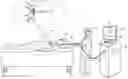 Fig. 01 - Automatic adjustment of electrode surface impedances in multi-electrode catheters