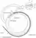 Fig. 01 - Method for positioning terminal end of pacemaker lead, which has passed through coronary sinus, in interventricular septum