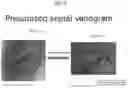 Fig. 08 - Method for positioning terminal end of pacemaker lead, which has passed through coronary sinus, in interventricular septum