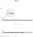 Fig. 09 - Method for positioning terminal end of pacemaker lead, which has passed through coronary sinus, in interventricular septum
