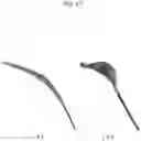 Fig. 19 - Method for positioning terminal end of pacemaker lead, which has passed through coronary sinus, in interventricular septum