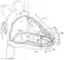 Fig. 01 - Delivery devices and methods for leadless cardiac devices